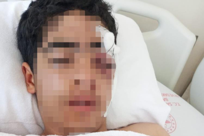 Akran zorbalığına bir yenisi eklendi