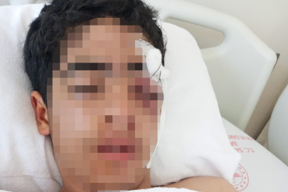 "Bana şaka yapma" dediği arkadaşının muştayla saldırdığı 15 yaşındaki çocuğun gözünü kaybetme tehlikesi bulunuyor