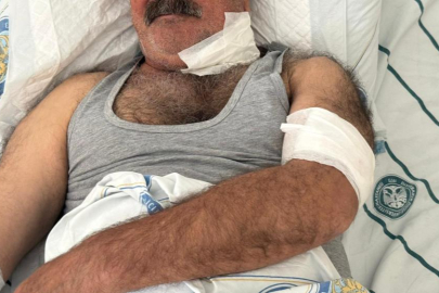 At sahibini boğazından ısırarak ağır yaraladı