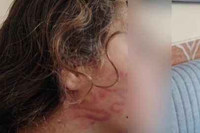 Çocuğu darp ettiği öne sürülen kadın ise darp etmediğini elinin değmiş olabileceğini söyledi