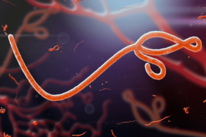 Ebola Virüsü Yeniden Gündemde: Belirtileri ve Etkileri Neler?
