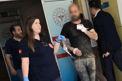 Makineye kaptırdığı parmağı koptu