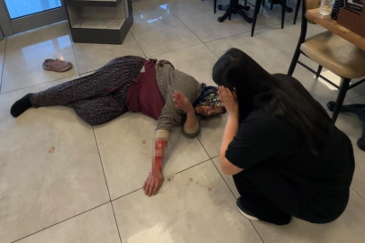 Tekmelere aldırmayan köpek kadının kolunu kopardı