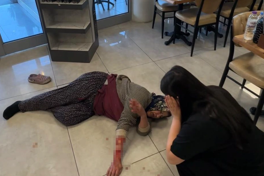 Tekmelere aldırmayan köpek kadının kolunu kopardı