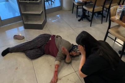 Tekmelere aldırmayan köpek kadının kolunu kopardı