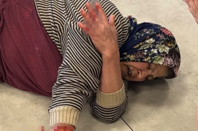 İki kişinin durduramadığı köpek, yaralı kadına zarar vermek için tesise girmeye çalıştı