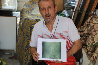 Belinde panç unutulan adam, işsiz kalarak mağdur oldu