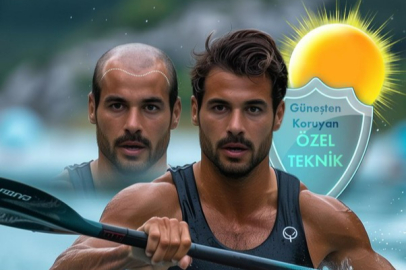 Sunguard Saç Ekimi Fiyatları Neye Göre Belirleniyor?