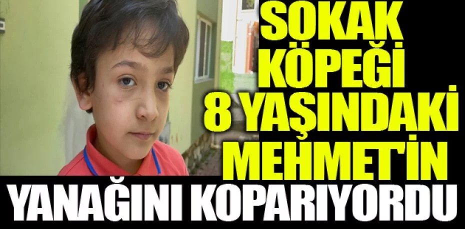 Sokak köpeği 8 yaşındaki Mehmet'in yanağını koparıyordu