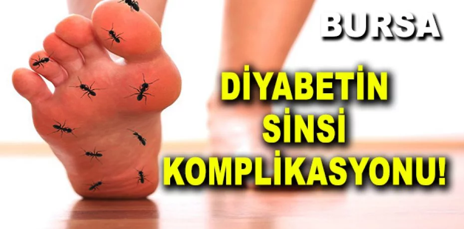 Diyabetin sinsi komplikasyonu polinöropati