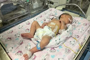 Annesi Kazada Ölüp Sezaryenle Dünyaya Gelen Bebek Hayata Tutundu