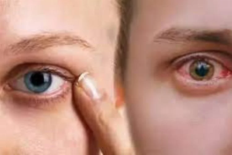 Uzmanlar uyarıyor: Gözleri koruma yolları neler?
